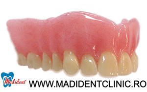 Proteza dentară 