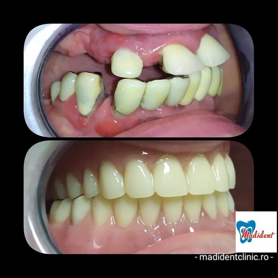 implantologia orală