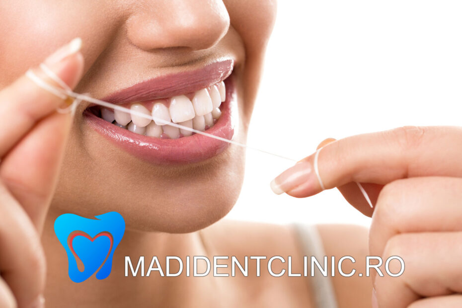 Igienizarea dentară este un proces important în menținerea sănătății orale.